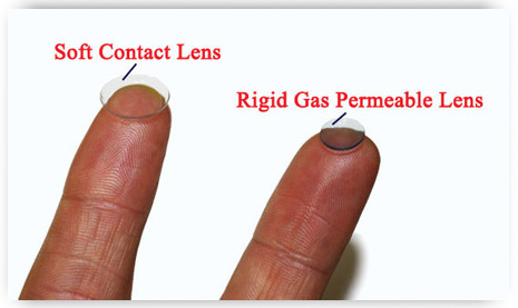rigid gas permeable lens and a soft contact lens side by side - keratoconus contact lens fitting